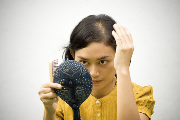 ¿Cual es tu tipo de alopecia?