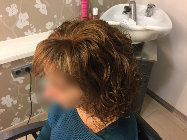 ¿Qué es Onco&Hair?